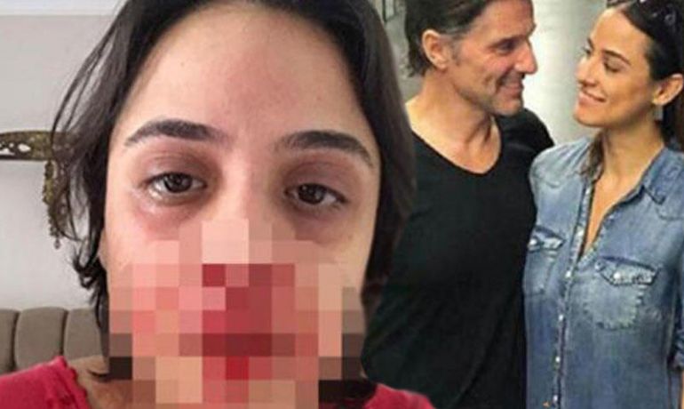 Sevgilisini döydüyü üçün serialdan qovuldu