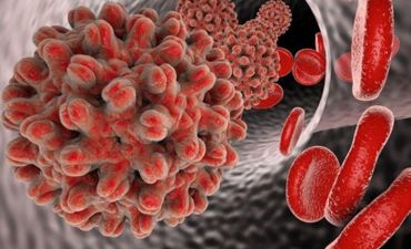 Virus hepatitləri nədir?
